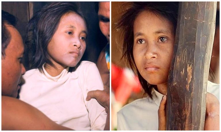 Amazing Stories of 15 Feral Children Who Were Raised by Animals